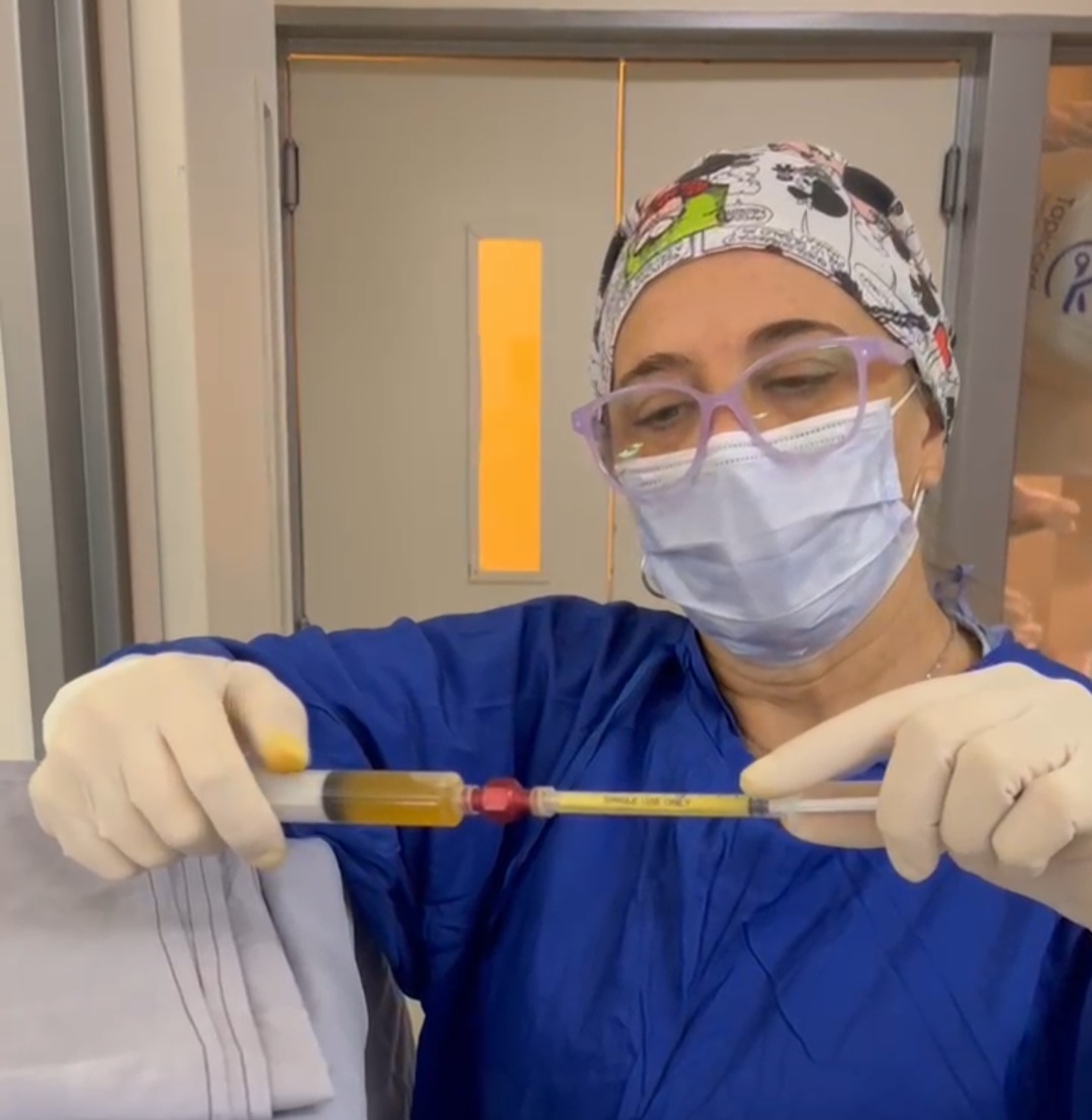 Preparación de Nanofat micrograft autólogo en quirófano